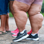 Prefeitura de Manaus inaugura primeiro Centro de Combate à Obesidade e amplia acesso ao tratamento especializado